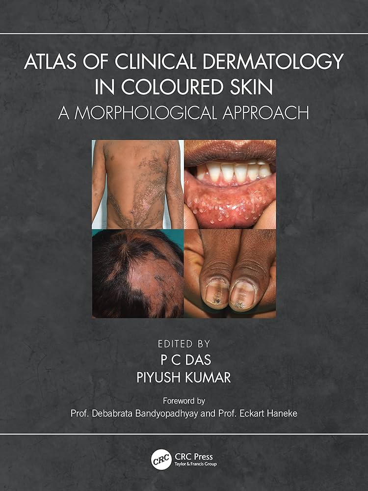 2冊The CurrentColorAtlas of Skin Diseases Atlas of Skin Disorders: Challenging Presentations of Common